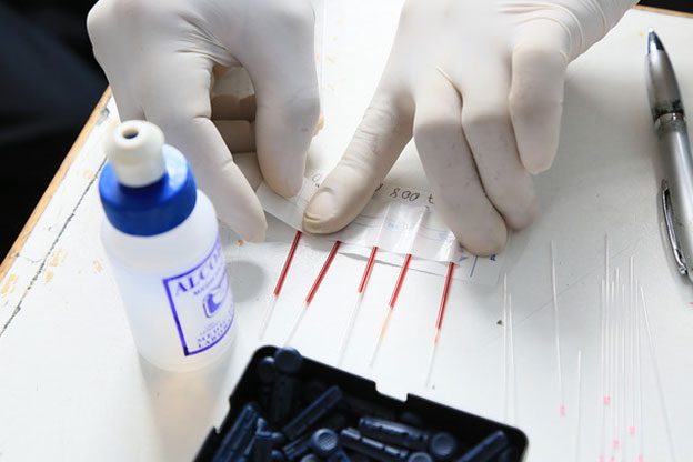 anemia Anemia